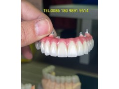 深圳种植牙厂家 深圳种植牙加工厂 种植牙出口外贸图3