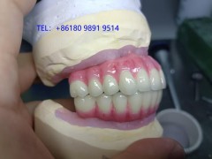 深圳种植牙生产厂家出口,深圳假牙加工厂图5
