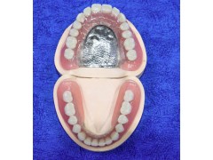 深圳假牙种植牙义齿加工厂家_OEM定制出口