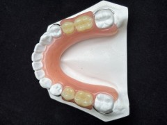 深圳假牙种植牙义齿加工厂家_OEM定制出口图3