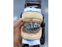 深圳假牙出口欧美认证义齿生产厂家 外贸出口义齿产品图3