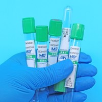 绿色管帽含肝素锂抗凝剂PET材质真空采血管_抽血管